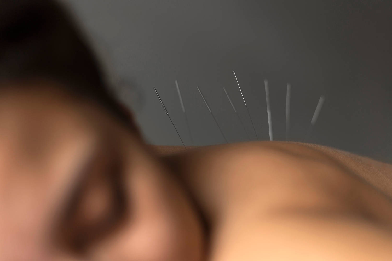 close-up-patient-during-acupuncture-procedure